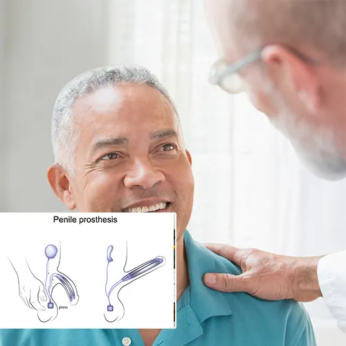 Understanding the Importance of Aftercare for Penile Implants